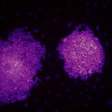 Stem cells could offer new hope for unlocking the secrets of bipolar disorder.