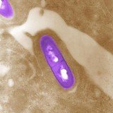 Listeria