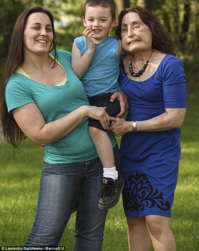 The attack and face transplant has given Connie Culp a new love of life and she enjoys playing with her grandson Maddox, with help from daughter Alicia