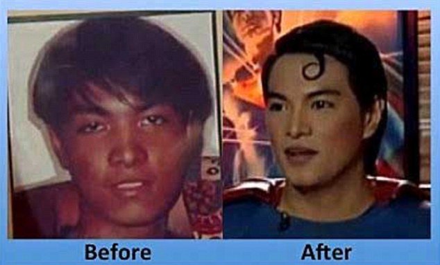 Herbert Chavez before and after plastic surgery