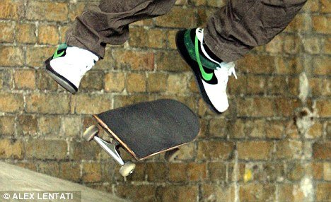 The teenager was reportedly encouraged to “film the crazy stuff he does” but suffered a severe head injury when falling from his skateboard (file picture)