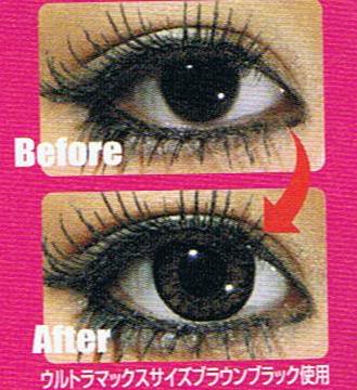 Circle lenses: before and after they were put into the eyes (Anime look).
