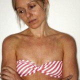 Charlotte Cripps was shocked when she felt “excruciating pain” as the technician ran a hand-held machine over her chest and face at a London spa