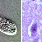 Naegleria fowleri causes amebic meningoencephalitis, a brain infection that leads to the destruction of brain tissue