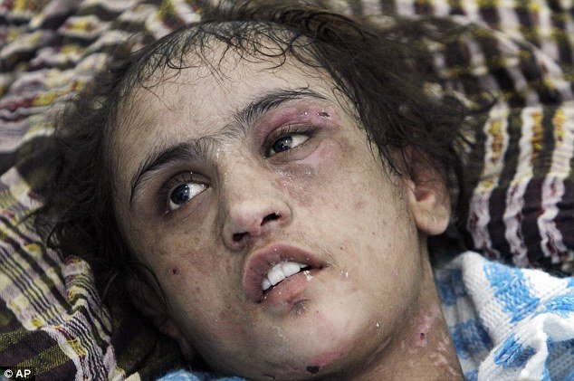 15-year-old Sahar Gul became the bruised and bloodied face of women's rights in Afghanistan after she was rescued in late December when an uncle called police