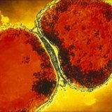 Cooling babies with birth asphyxia stops brain damage | BelleNews.com