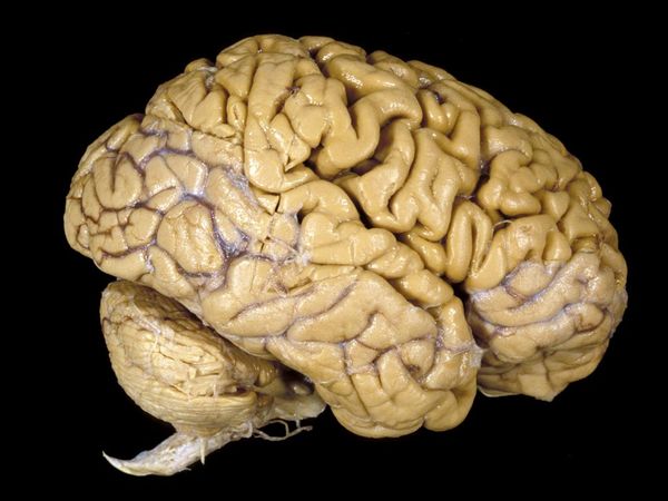 The brain' skills can start to decline as early as 45, much earlier than previously thought, suggests a study published in the British Medical Journal