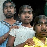 In an incredible quirk of fate, three sisters from a small village near Pune, central India, have all been blighted by a condition known as werewolf syndrome - where they are covered from head to foot in thick hair