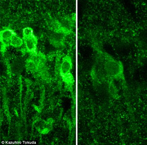 Neurons in the hippocampus exposed to large amounts of alcohol produce steroids, which inhibit the formation of memory (left), vs. normal neurons (right)