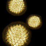 The research found that the African-American women were clearing HPV virus about six months longer