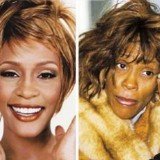 Whitney Houston's autopsy report has revealed that large parts of her skin were burnt off from the scalding hot bath in which she was found