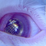 A bionic eye which is powered by light has been invented by scientists at Stanford University in California