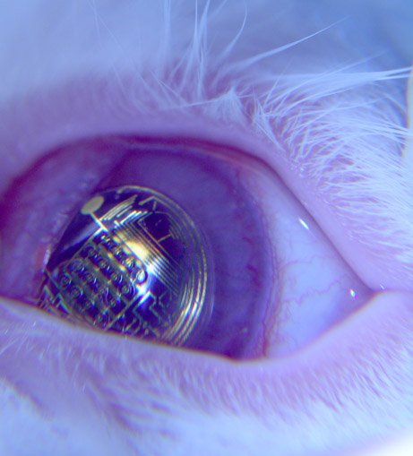 A bionic eye which is powered by light has been invented by scientists at Stanford University in California