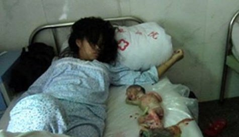 Feng Jiamei was forced into the abortion as she could not pay the fine for having a second child, US-based activists said