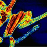 A deadly outbreak of Ebola virus has killed at least 13 people and infected a further seven in Uganda