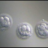 Preimplantation genetic diagnosis (PGD) can help doctors spot diseases like cystic fibrosis before deciding whether to continue with fertility treatment