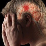 Clots block blood vessels, starving parts of the brain of oxygen, which leads to symptoms such as paralysis and loss of speech