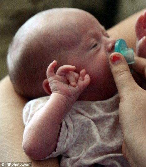 babies born with extra fingers #10