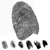 The vast majority of people are born with a unique set of fingerprints which remain the same for life