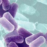 CDC is warning doctors to be on the lookout for untreatable multidrug-resistant CRE superbug emerging in the US