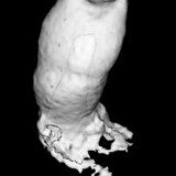 A research team from King's College London took cells from adult human gum tissue and combined them with another type of cell from mice to grow a tooth
