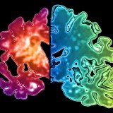 US researchers from Washington University School of Medicine have identified genetic markers that could help highlight who is at risk of developing Alzheimer's disease