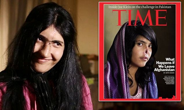 Aesha Mohammadzai has made international headlines in 2010 when she appeared on the now-iconic cover of Time magazine with a gaping wound in the center of her face where a nose should be