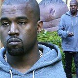 Kanye West hit his head on a caution sign on Friday while on a lunch date with Kim Kardashian