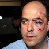 Opposition deputy Julio Borges appeared on a local TV station with facial bruises after Venezuela’s parliament brawl