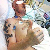 Polish doctors say they have performed a total face transplant on a 33-year-old man whose face was torn off in an accident with stone-cutting machinery