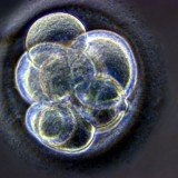 The technique used for human cloning, somatic cell nuclear transfer, has been well-known since Dolly the sheep became the first mammal to be cloned