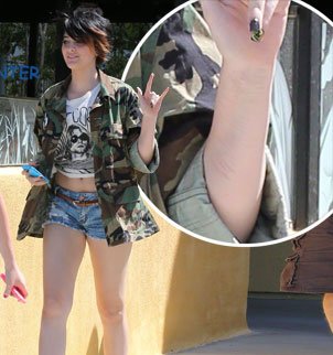 Paris Jackson was seen six weeks ago with a crop of scars on her forearm