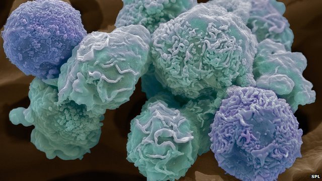 Cancer researchers charted 21 major mutations behind the vast majority of tumors