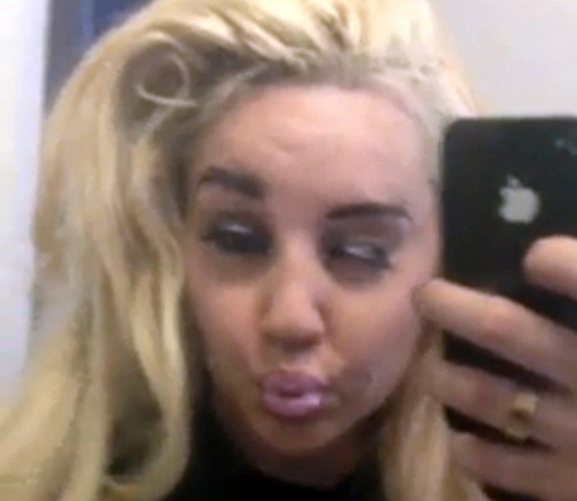 Amanda Bynes is still going for treatment in a California hospital and will need 18 months to complete that treatment
