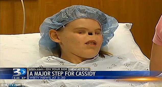 Cassidy Hooper, who was born with no eyes or nose, is just days away from a surgery that will give her a nose