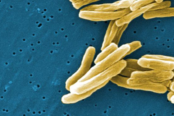 The origins of human tuberculosis have been traced back to hunter-gatherer groups in Africa 70,000 years ago