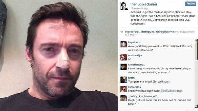 Hugh Jackman revealed he has been treated for skin cancer after seeking advice for a mark on his nose