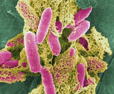 Food poisoning bacterium Clostridium perfringens may be implicated in Multiple sclerosis