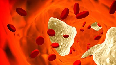 HDL cholesterol also has a nasty side that can increase the risk of heart attacks