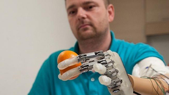 Dennis Aabo, who lost his left hand in a firework accident nearly a decade ago, said the bionic hand was amazing