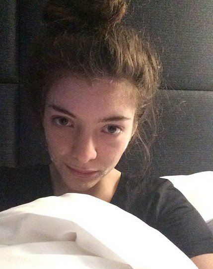 Lorde proved that she really is just a typical teenager by sharing her acne-fighting skin care routine on Instagram