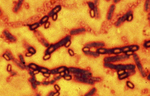 Anthrax disease is caused by a bacterium that occurs naturally in soil