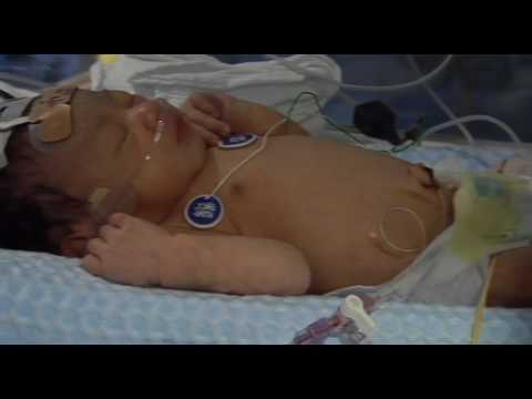 Cooling babies deprived of oxygen at birth improves their chances of growing up without disabilities such as cerebral palsy